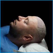 Radiant Locks Await: Experience PRP Hair Treatment in Dubai