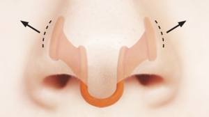 Internal Nasal Dilators Market Application, Trends, Opportunity and Forecast till 2031