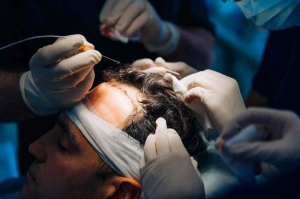 Beyond Vanity: Can Hair Transplants Be Considered a Medical Treatment in Islam?