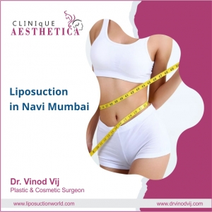 Transforming Bodies: Exploring Liposuction in Navi Mumbai with Dr. Vinod Vij, Pioneer of Plastic Surgery