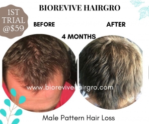 Transform Your Hair with BioReviveHairGro: The Top 10 Benefits