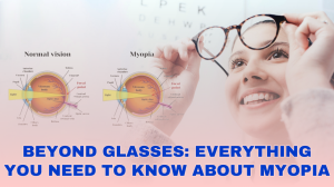 Beyond glasses: Everything you need to know about myopia