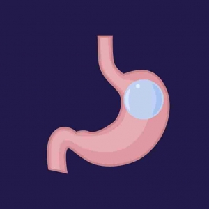 Real Results: Gastric Balloon Experiences in Dubai