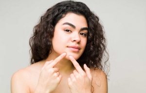 How Long Does It Take for a Dermatologist to Cure Acne?