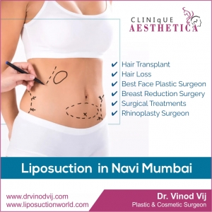 Trimming to Perfection: Exploring Liposuction in Navi Mumbai with Dr. Vinod Vij's 25+ Years of Expertise