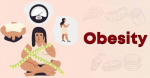 A Comprehensive Overview of Obesity Management: Spotlight on Bariatric Surgery