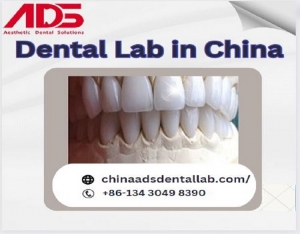 Chinaadsdentallab: Your Full-Service Dental Lab in China for Premium Dental Solutions