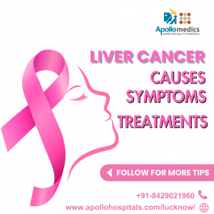 Liver Cancer Causes, Symptoms & Treatments