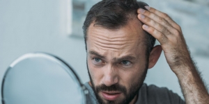 What is the best treatment for hair loss?