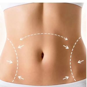 Shaping Up in Navi Mumbai: Dr. Vinod Vij's Expertise in Liposuction for Removing Excess Body Fat