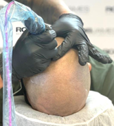 Deciding on Scalp Micropigmentation (SMP) : A Comprehensive Guide to Making the Right Choice