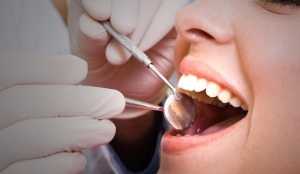 Root Canal Treatment in Dubai,A guide