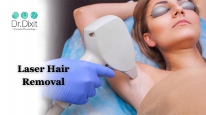 Top Factors to Determine The Cost of Laser Hair Removal