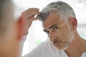 Can Hair Loss Be Reversed Without Surgery?