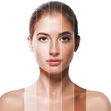 Comprehensive Guide to Laser Treatments for Permanent Skin Whitening