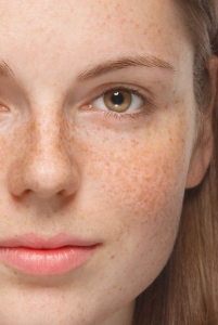 Dubai's Top Dermatologists Reveal Best Pigmentation Treatments