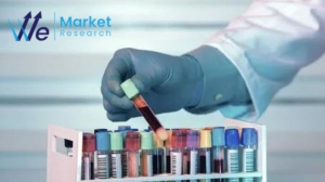 Biobanking Market Report, Size & Forecast by 2023-33