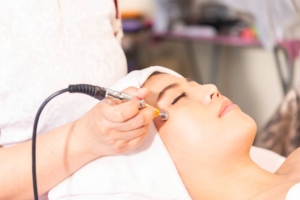 How Much Does Laser Acne Scar Treatment Cost? Understanding the Expenses