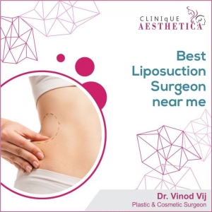 Finding the Best Cosmetic Surgeon Near You: Dr. Vinod Vij's Expertise in Liposuction, Tummy Tucks, and Rhinoplasty