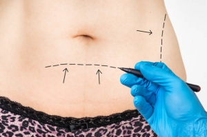 Expert Surgeons for Buccal Fat Removal in Abu Dhabi: How to Choose the Best