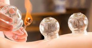 Cupping Therapy in Noida By Gopt India