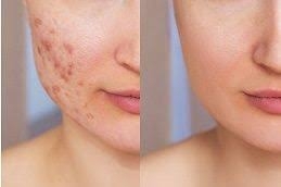 Investigating Glutathione's Impact on Skin Health