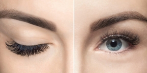 Visionary Enhancements: Meet the Best Eyelid Surgery Doctor in Riyadh