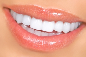 Finding the Right Price for Dental Veneers in Dubai 