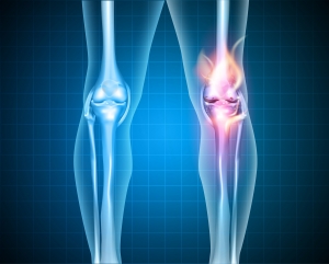 Osteoarthritis Therapy Market Size, Share, Growth Drivers, Key Expansion and Forecast 2031