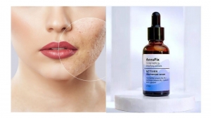Top 10 Benefits of Niacinamide Serum for Your Skin