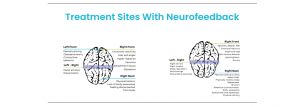 Detailed Overview of Cygnet Neurofeedback