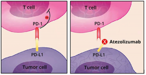 Atezolizumab Market to Witness Robust Growth Due to Increase in Oncology Diseases
