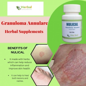 Granuloma Annulare Causes, Symptoms, Natural Remedies   