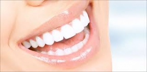 Teeth Whitening: Natural vs. Chemical Methods