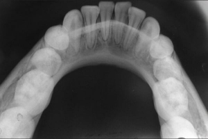 The Average Price Range for Panoramic Dental X-Rays in Dubai