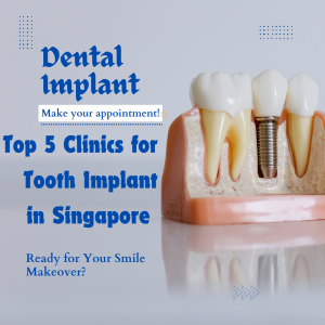 Top 5 Clinics for Tooth Implant in Singapore