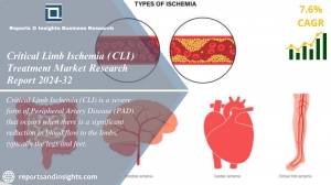 Critical Limb Ischemia Treatment Market Size, Share 2024-2032