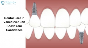 Dental Care in Vancouver Can Boost Your Confidence