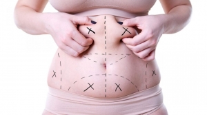 Where Does Liposuction Cost in Dubai Come From?