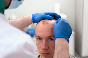 The Quest for the Perfect Hairline: Discovering the Best Hair Transplant in Dubai