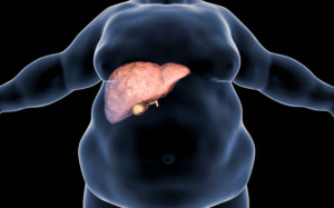 Healing Fatty Liver: Ayurvedic Insights