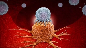 Immunotherapy A Game Changer in Blood Cancer Treatment