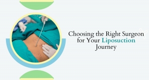 Choosing the Right Surgeon for Your Liposuction Journey