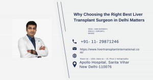 Why Choosing the Right Best Liver Transplant Surgeon in Delhi Matters