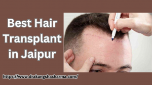 What are the Benefits of Hair Transplant?