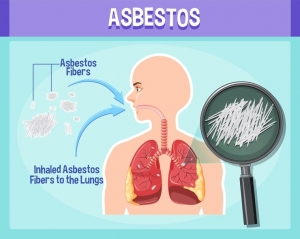 Your Guide to Mesothelioma Lawyer Directories