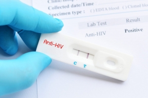 Asia Pacific HIV Diagnostics Market is Anticipated to Witness High Growth Owing to Rising Prevalence of HIV Infection