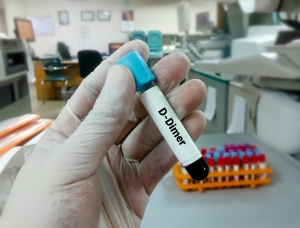 D-dimer Testing Market Growth Analysis and Growth - 2031
