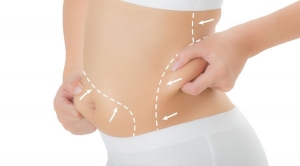 Unveiling the Numbers: A Breakdown of Laser Lipo Prices in Dubai