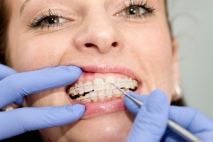 Selecting the most appropriate Orthodontist in Reno NV